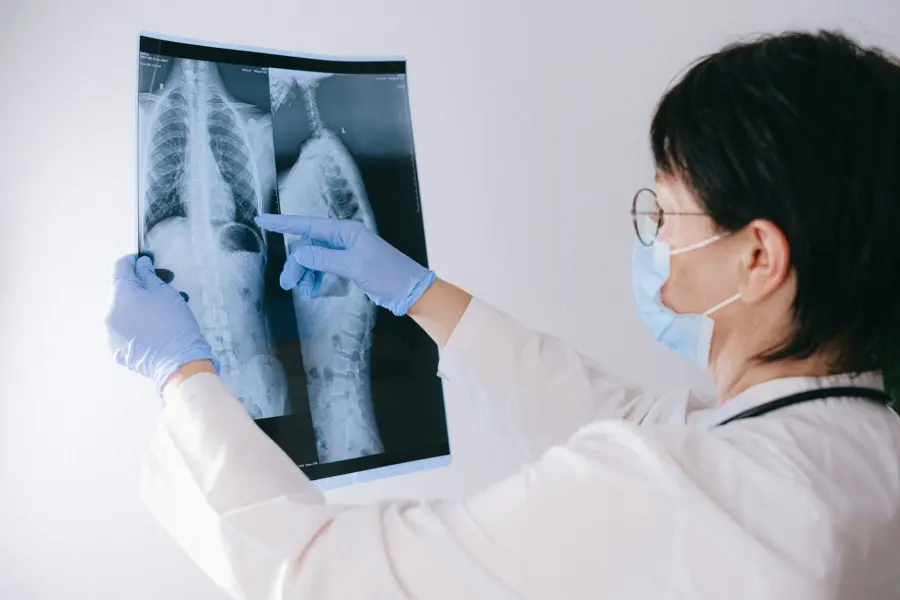 Dischi Intervertebrali: Anatomia e Patologie