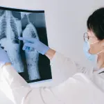 Dischi Intervertebrali: Anatomia e Patologie